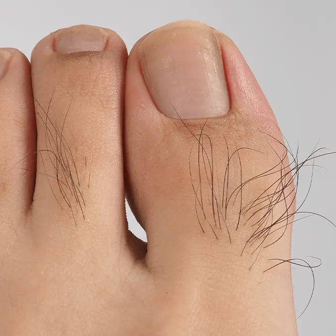 No Toe Hair? Too Much Toe Hair? Here's What It Could Mean for Your Body.