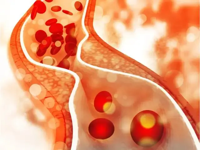6 Essential Vitamins That Help Support Healthy Arteries and Better Heart Health