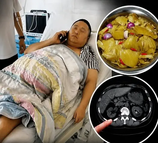 Doctors Find a Possible Link to Eating One Type of Pickled Vegetable for Nearly 10