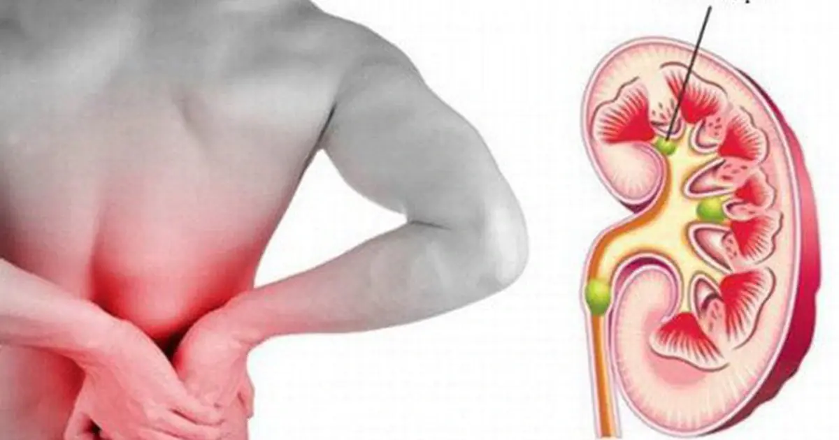 Healthy Kidneys Matter: Watch for These Signs and Learn Habits That Support Kidney Health
