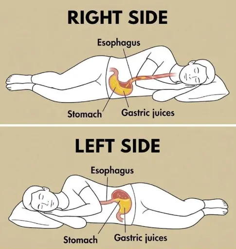 Warning: Sleeping on Your Right Side Every Night May Affect Your Health