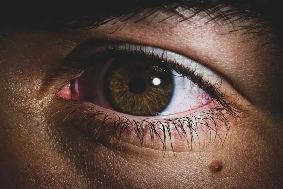 He Ignored a Tiny Mole for More Than 20 Years—Until It Nearly Cost Him His Life
