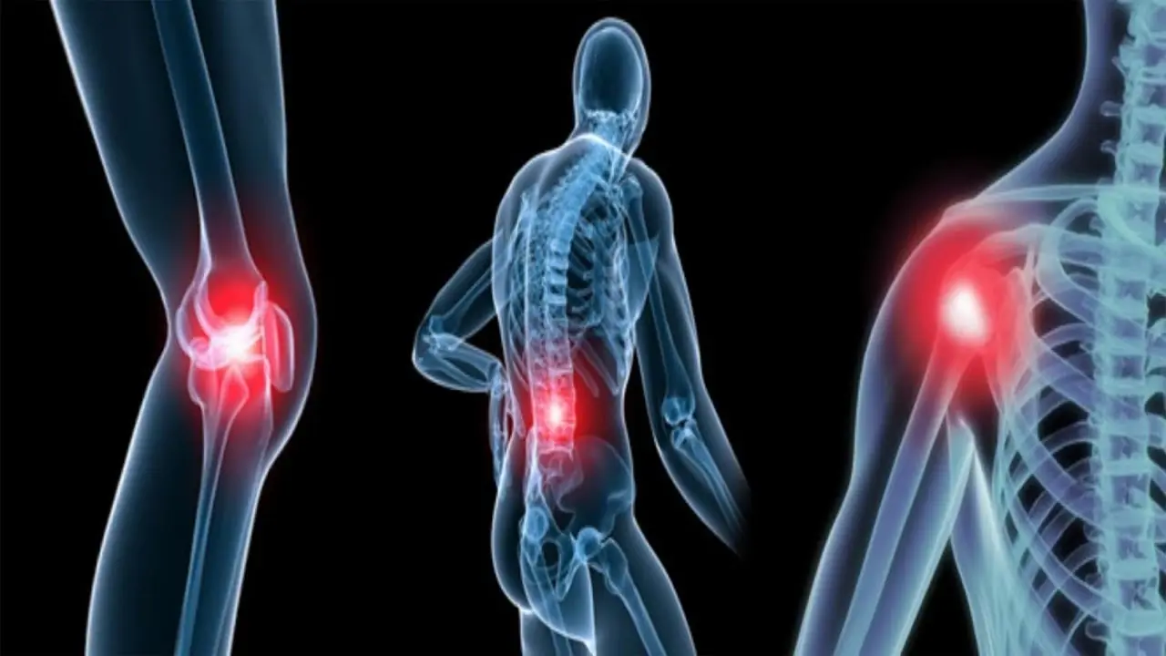 8 Foods That May Contribute to Poor Bone Health if Overconsumed
