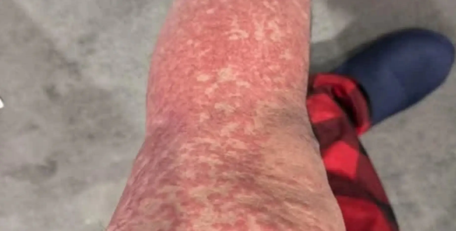 Here are the consequences of sleeping with… See more