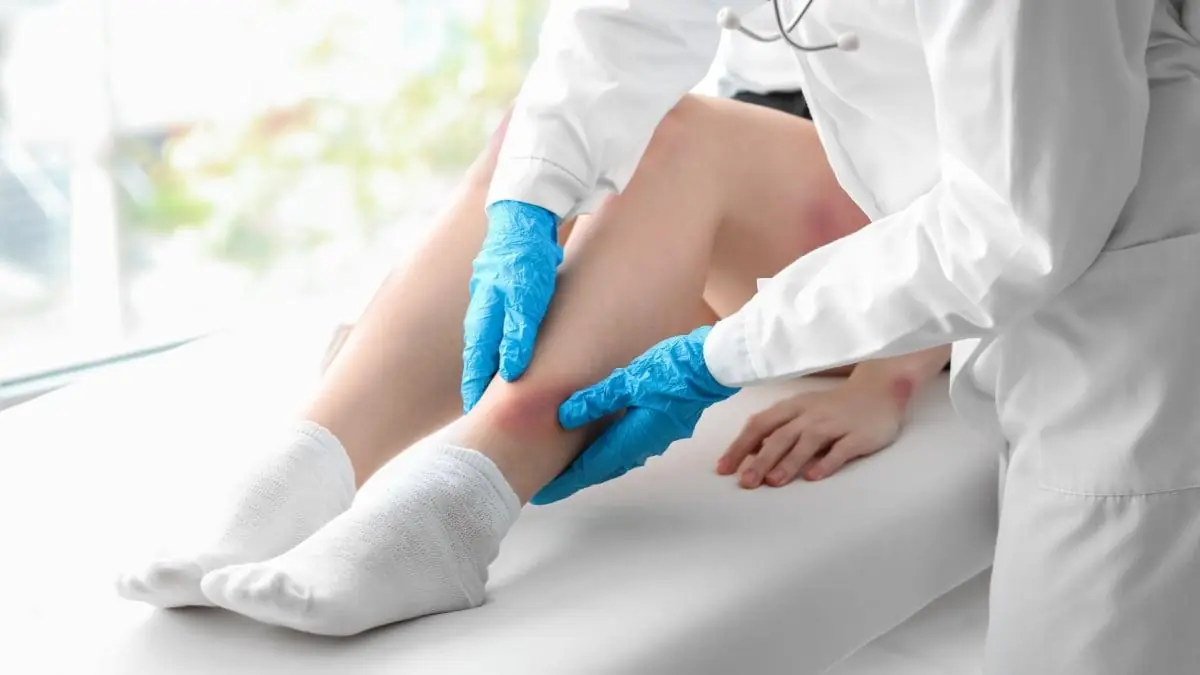 A Small Skin Spot Turned Into a Medical Emergency: Why Serious Skin Infections Should Never Be Ignored