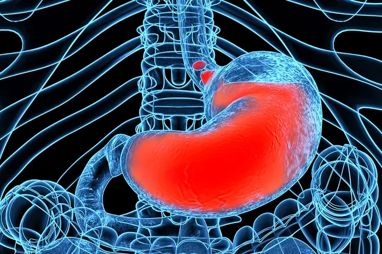 Acid Reflux Explained: Common Causes and 5 Natural Ways to Help Manage Symptoms