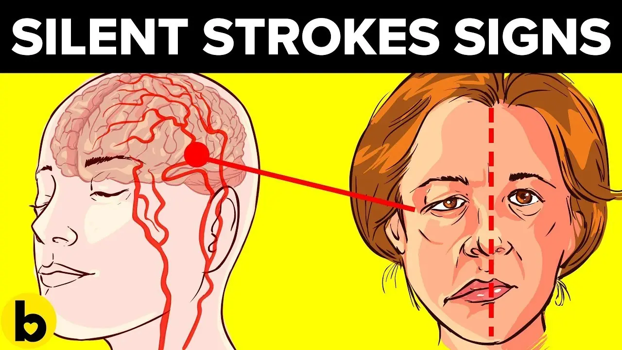 5 Warning Signs of a Mini Stroke in Older Adults You Should Never Ignore