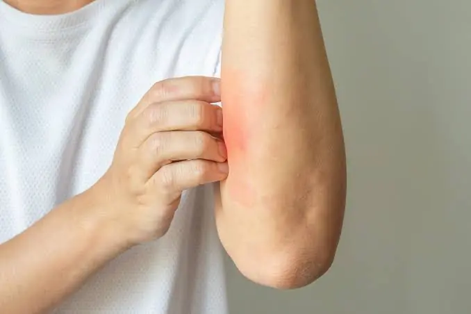 These 9 Strange Itching Symptoms May Be Your Body's Early Warning Signals
