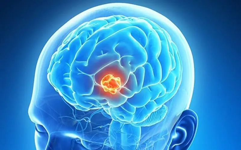Your Brain Could Be Sending These Early Warning Signals - Here's What to Know