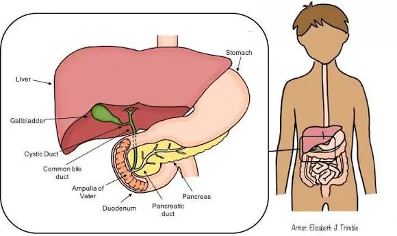 Millions Experience These Symptoms Without Knowing Their Gallbladder May Be Involved