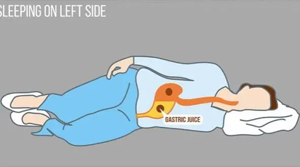 Sleeping on Your Right Side Isn't Always the Same for Everyone—Learn the Potential Benefits and Risks