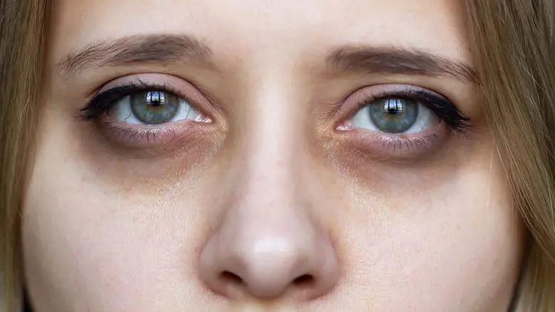 Here are the consequences of sleeping with a… See more