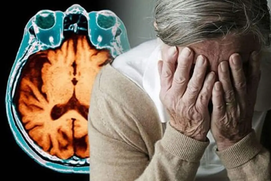 4 Possible Early Warning Signs of Alzheimer's Disease