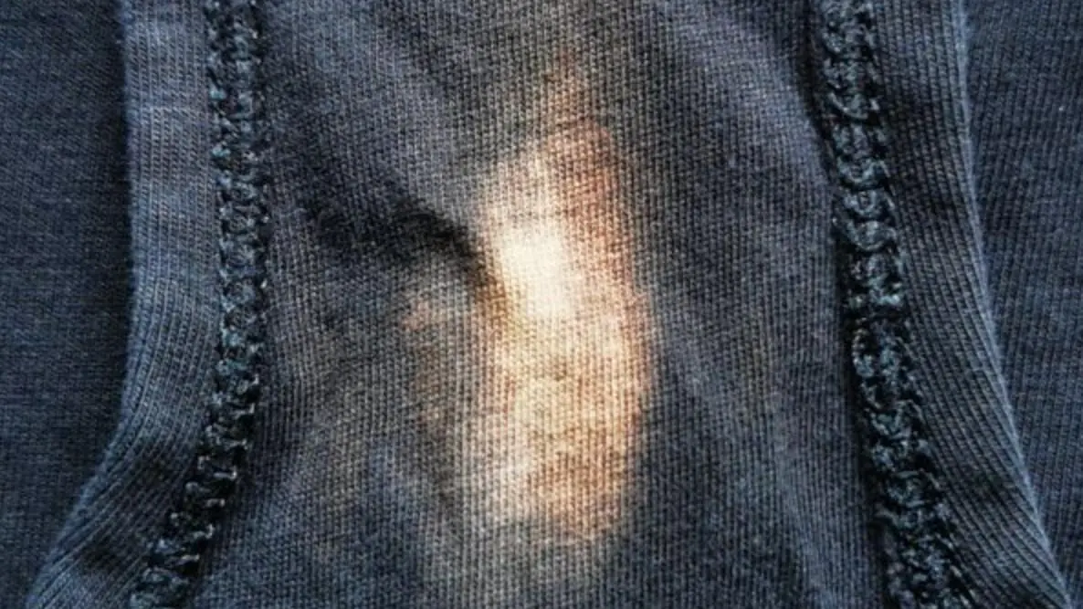 The Surprising Truth Behind Those “Bleach-Like” Stains on Your Underwear