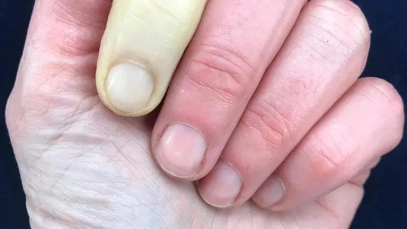 These are the consequences of sleeping with the… See more