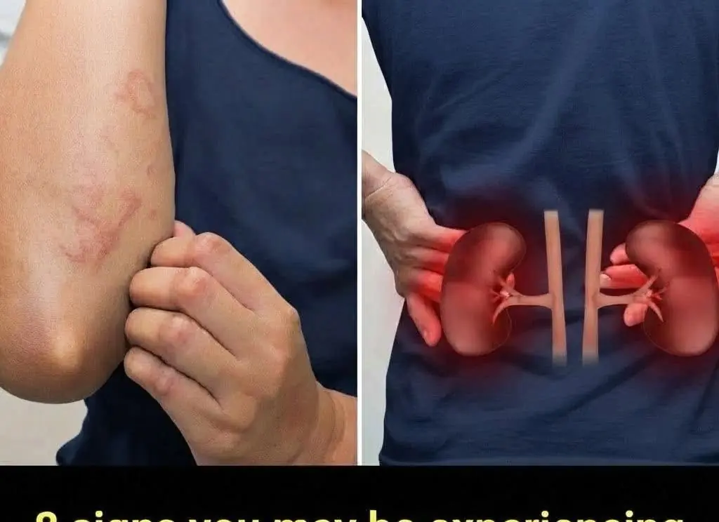 Warning Signs That May Indicate Kidney Problems..