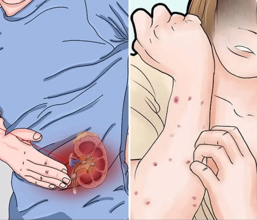 Your kidneys could be silently struggling