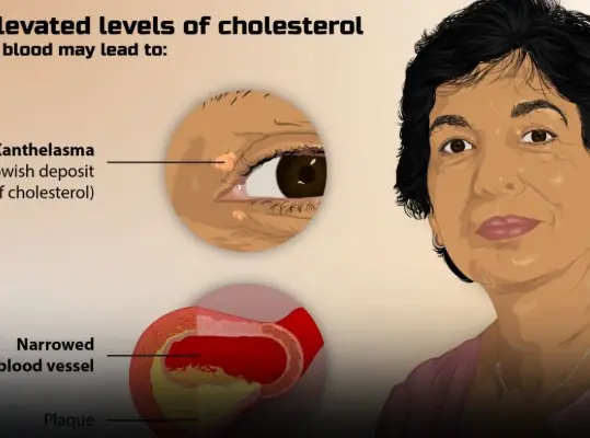 Food safety mistakes can lead to serious health risks and emergencies.