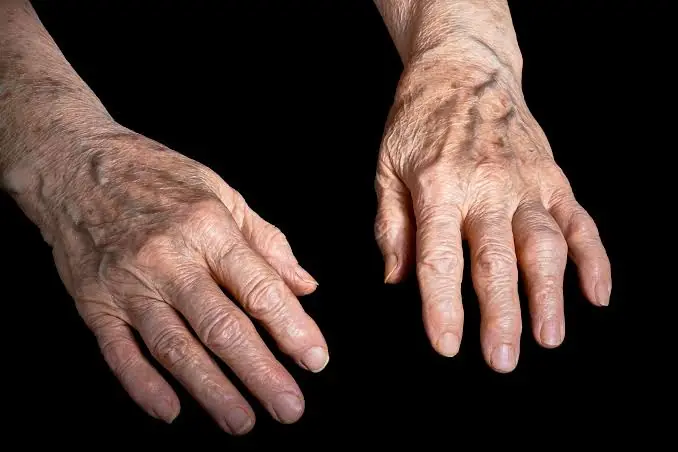 Your Hands May Be Revealing More Than You Think—Here's What Visible Veins Can Mean
