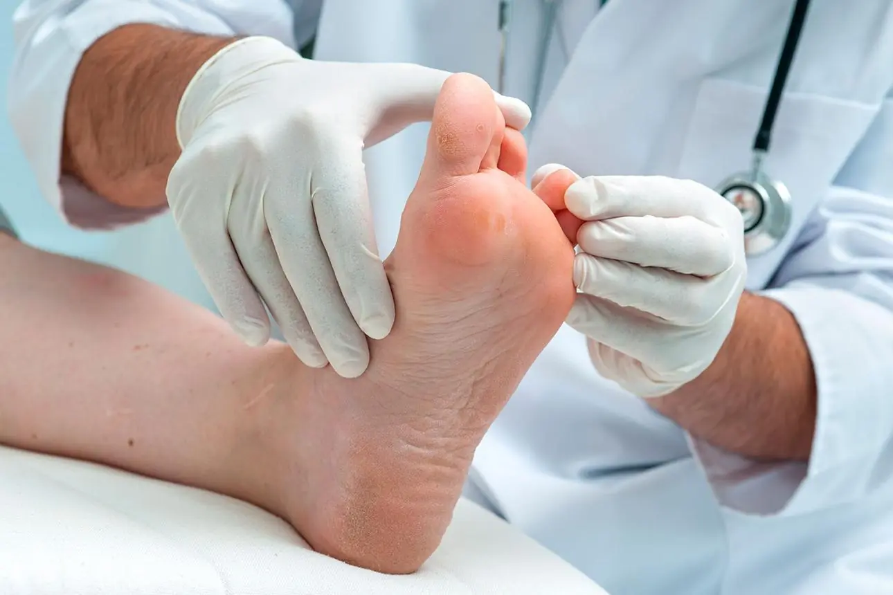 12 Warning Signs Your Feet May Reveal About Blood Sugar Problems