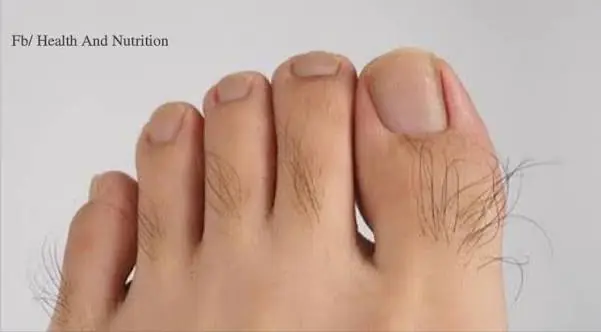 Many Women Overlook This Small Detail on Their Feet—But It May Matter