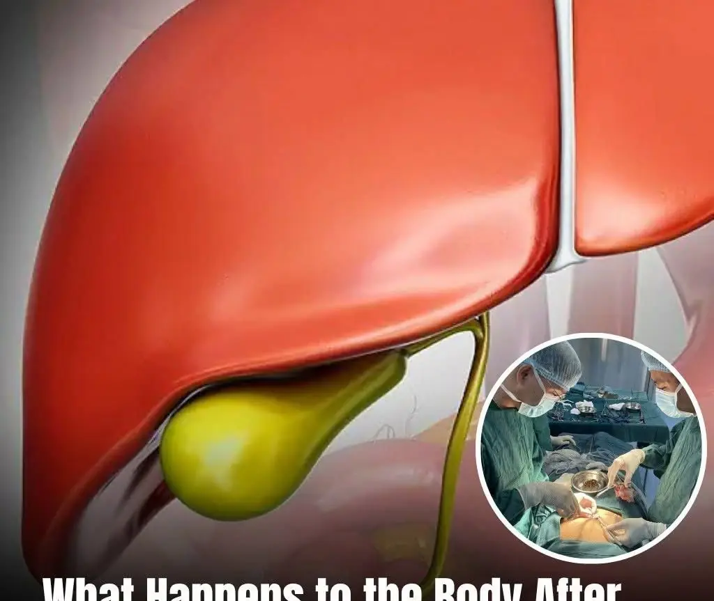 What Happens to the Body After G.allb.la.dder Removal