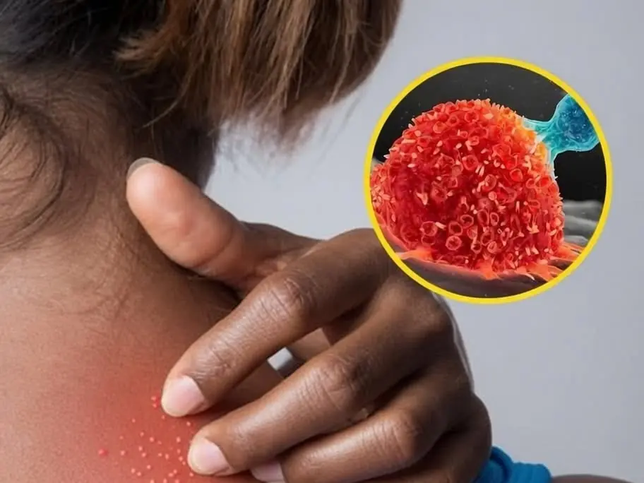 Experts Explain 9 Types of Itching That May Indicate an Underlying Condition
