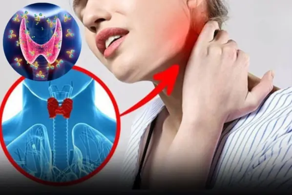 5 Early Signs of Thyroid Cancer That Are Easy to Recognize