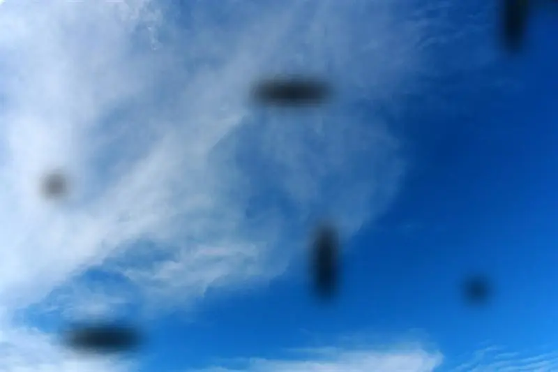Are Eye Floaters Dangerous? Here’s What Eye Doctors Want You to Know