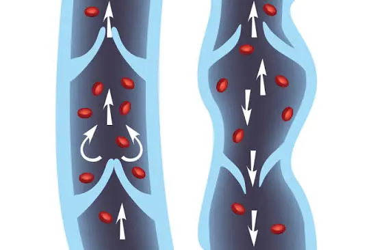 Your Legs Depend on Good Circulation — Here Are 6 Habits Worth Adding to Your Routine