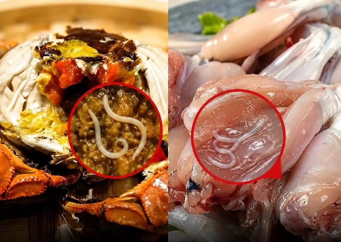 Doctors Warn: These 4 Popular Foods May Hide Dangerous Parasites