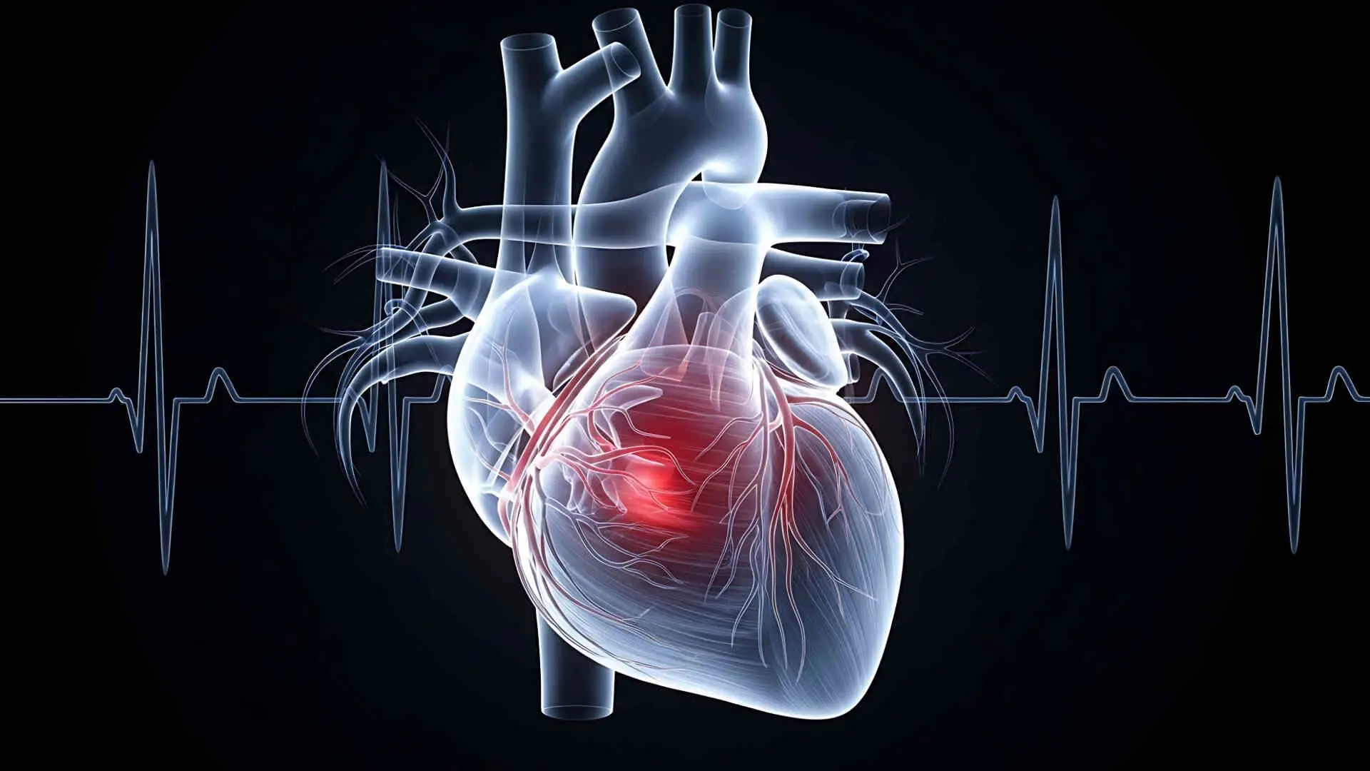 Your Body May Show These 7 Warning Signs Before a Heart Attack. Here's What Experts Want You to Know