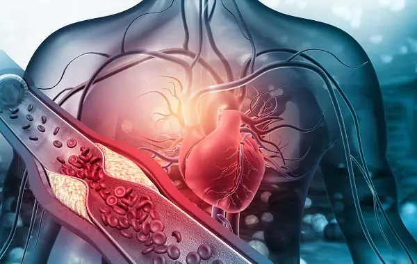 Start Your Day Right: 5 Morning Habits That May Affect Bl00d Pressure and Cholesterol