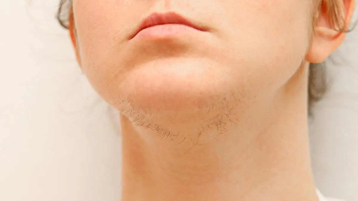 A Woman's Chin Hair Could Be a Sign of More Than Just Aging, Experts Say