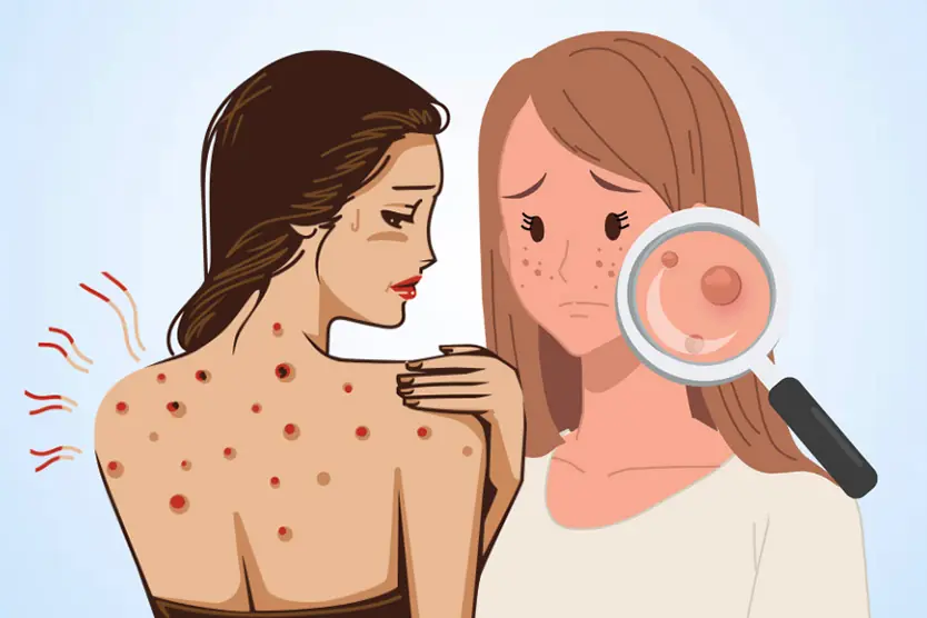 Fatty Liver Often Has No Obvious Symptoms — But These Signs May Be Worth Checking