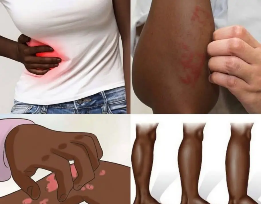 8 Signs Your Body May Show When Your Kidneys Need Attention