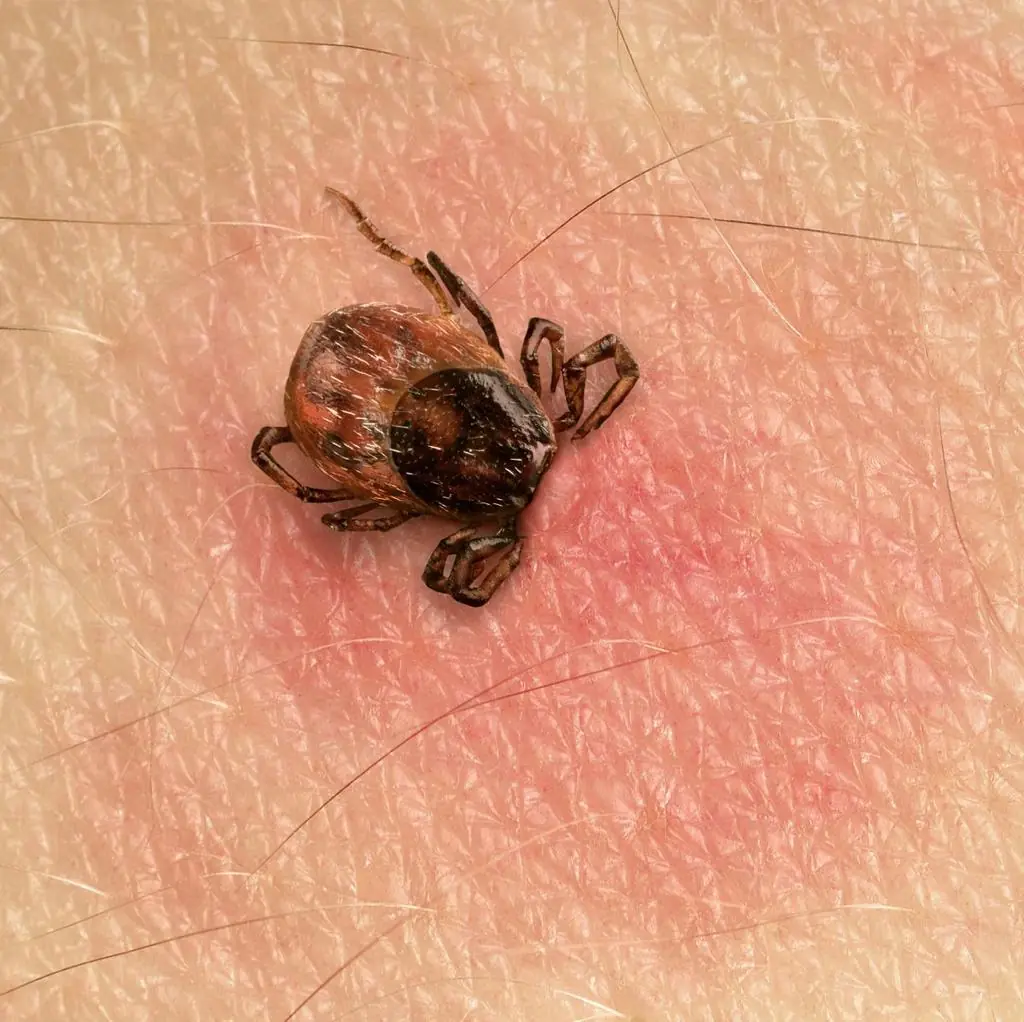 Found a Tick on Your Child? Here's What Every Parent Should Do Next