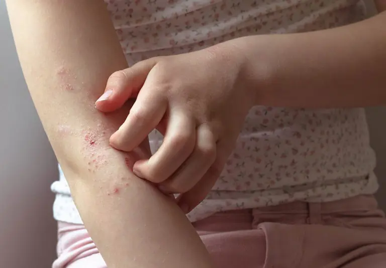 Persistent Itching in 10 Parts of the Body May Signal an Underlying Health Problem - Watch Out for Number 3