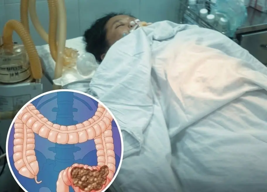 One warning sign. Age 25. Stage 3 colon c.ance.r. Don't ignore what your body is telling you.