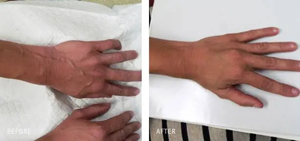 Pay Attention to Your Hands: These Changes May Be Early Clues to a Health Problem