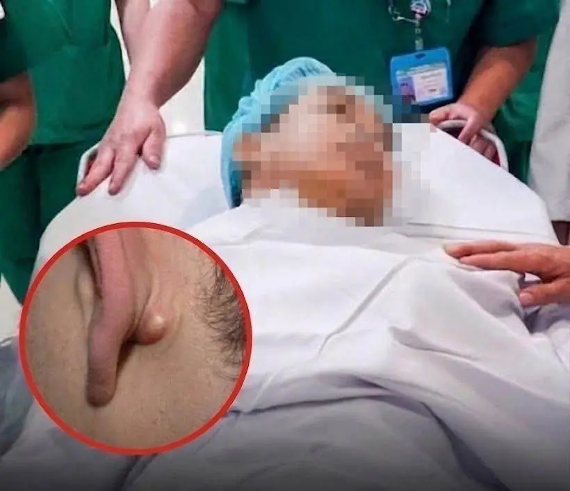 Young Man in His 20s D.i.es of C.anc.er After Ignoring Two Nighttime Symptoms