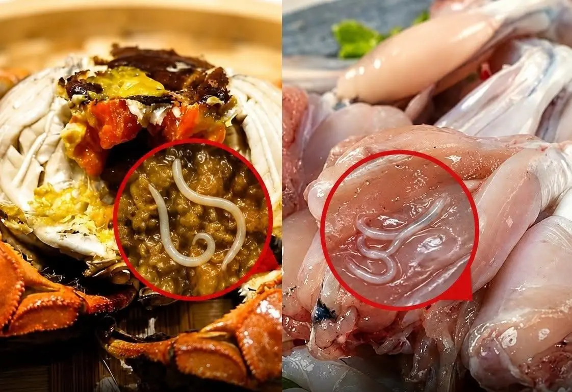 Doctors Warn: These 4 Popular Foods May Hide Dangerous Parasites