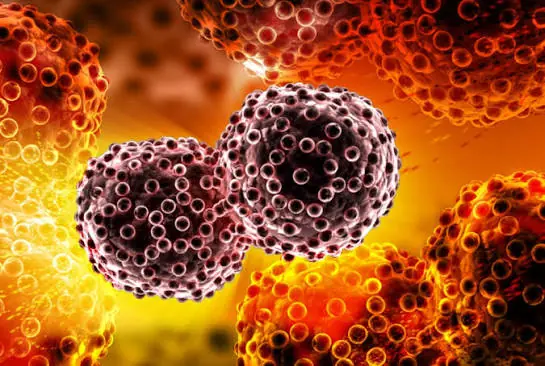 Could These Symptoms Be a Warning? 20 Possible Signs of Cancer in Women