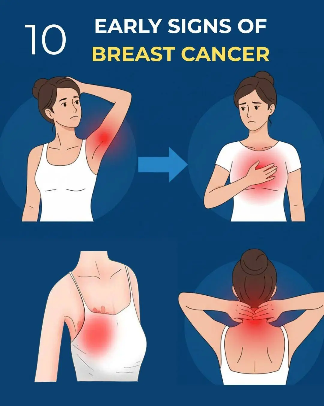 Early Detection Matters: 10 Potential Signs of Bre.ast Can.cer You Should Be Aware Of