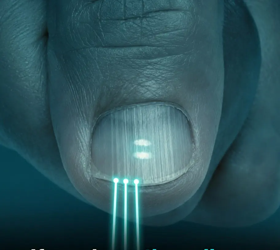 If you have these lines on your nails after 40, it is a clear sign that..