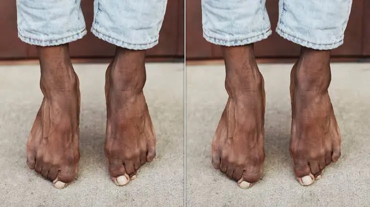 Toe Hair Isn’t Just Cosmetic—Here’s What It May Reveal About Your Health