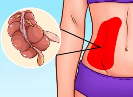 These 9 Symptoms Could Be Signs of Appendicitis - Know Them Early