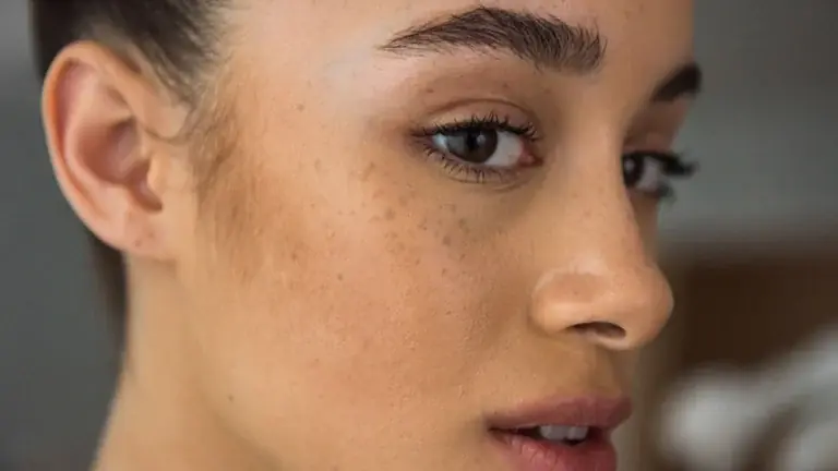 Not All Dark Spots Are the Same: 5 Signs You Shouldn't Ignore