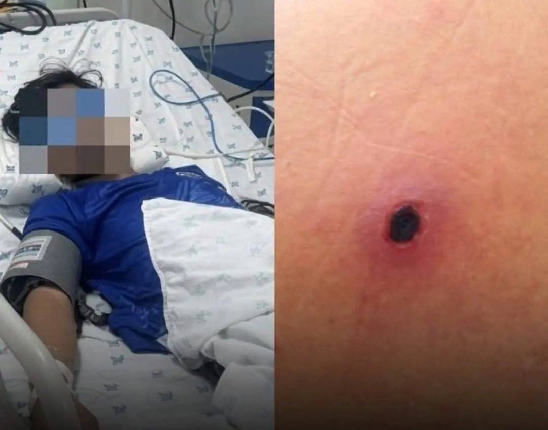 Doctor Lifted His Pant Leg, Then Ordered an Emergency ICU Transfer.