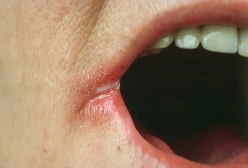 4 Subtle Signs on Your Face That Could Signal Health Problems